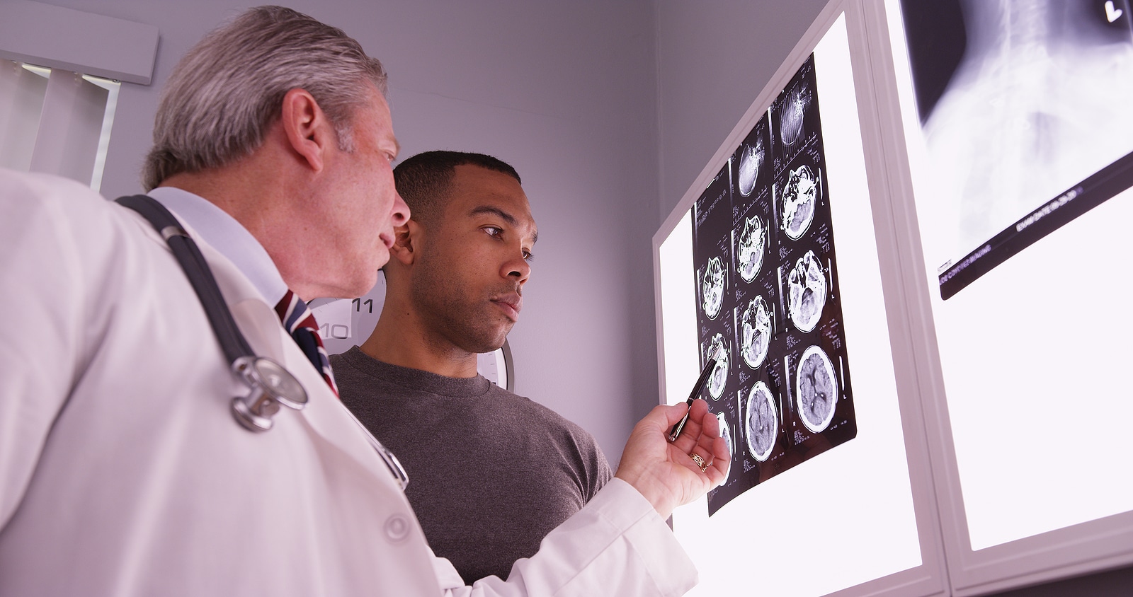 What Support Systems Are Available for Traumatic Brain Injury Survivors in Michigan